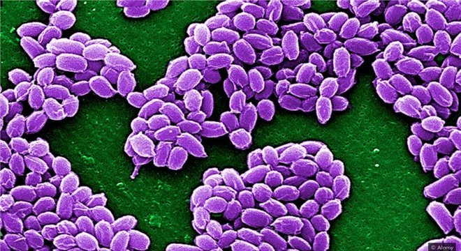 O descongelamento do permafrost liberou antraz na Sibéria