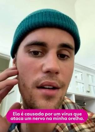 Ao atingir o gânglio do nervo facial, o vírus quase paralisia. Justin explicou justamente que está com um lado do rosto paralisado. 
