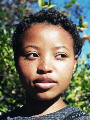 Sardas podem ser genéticas e podem surgir desde a infância. Porém, as chamadas sardas solares são adquiridas com o tempo e exposição solarLeia mais: Mulheres postam fotos sem edição para normalizar corpos reais