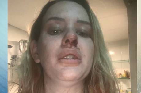 Fotos mostram sangue no rosto da arquiteta