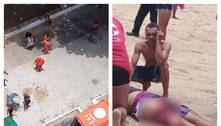 Adolescente é atacado por tubarão em praia de Pernambuco