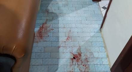 V?tima acordou com dores e sangue pelo corpo