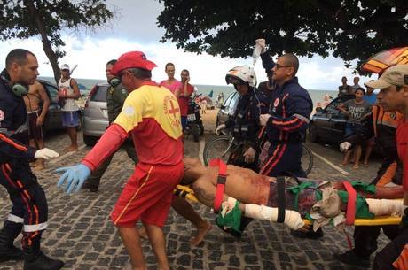 VÃ­tima teve a perna amputada e corre risco de morte