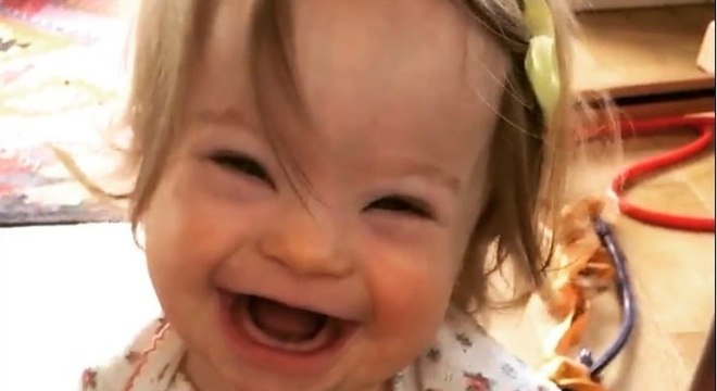 atriz bebe sindrome down