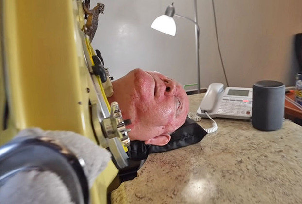 Atualmente com 77 anos, o estadunidense detém o recorde do Guinness Book como a pessoa que viveu mais tempo respirando com a ajuda dessa máquina.