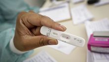 Por unanimidade, Anvisa aprova venda e uso de autotestes no Brasil 