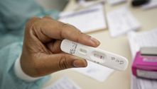 Por unanimidade, Anvisa aprova venda e uso de autotestes no Brasil