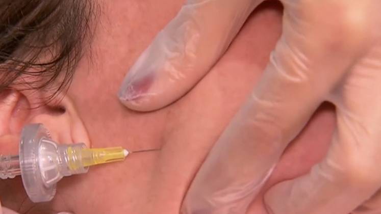 Outra informação ocultada são as sequelas permanentes na remoção do produto. Na retirada do PMMA, é extraído também partes do tecido. O cirurgião conta que, semanalmente, recebe de oito a dez pessoas com reações graves devido ao procedimento