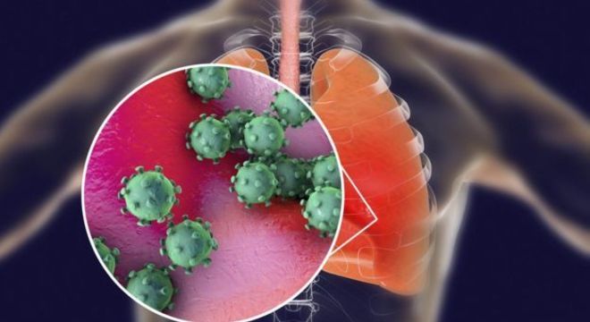 O coronavírus pode causar doença pulmonar grave
