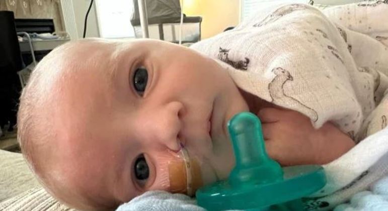 Owen Monroe foi o primeiro bebê no mundo a fazer transplante parcial de coração
