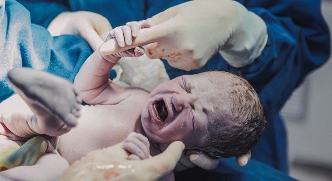 Obstetra diz que n&atilde;o &eacute; comum beb&ecirc;s segurarem [a m&atilde;o] quando dentro do &uacute;tero