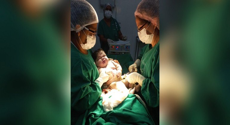 Chamado Angerson, o maior bebê do Amazonas nasceu na terça-feira (18)