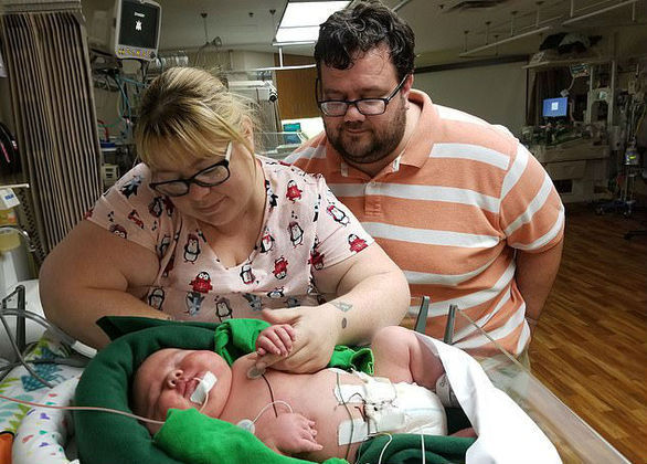 Bebe Gigante De Quase 7 Kg Deixa Ate Medicos Assustados Fotos R7 Hora 7