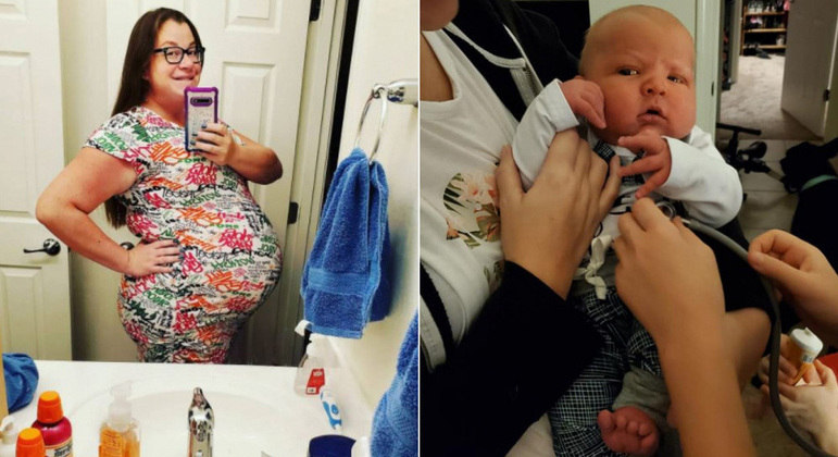 A Woman Gives Birth To A 6 3 Kg 60 9 Cm Baby In The United States News Www Diglogs Com Brasil