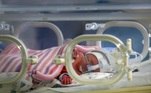 bebê na incubadora