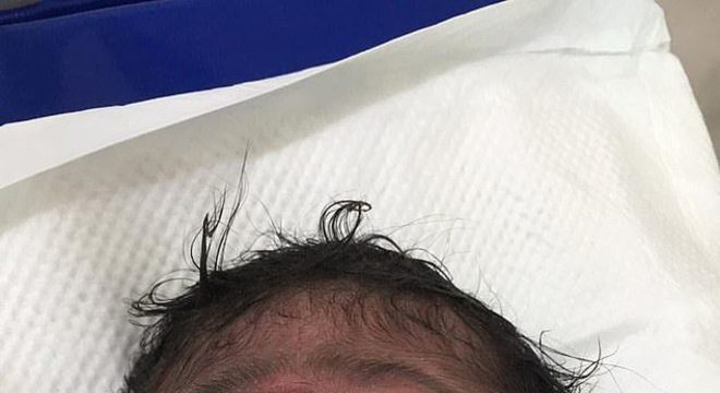 bebe nariz raro