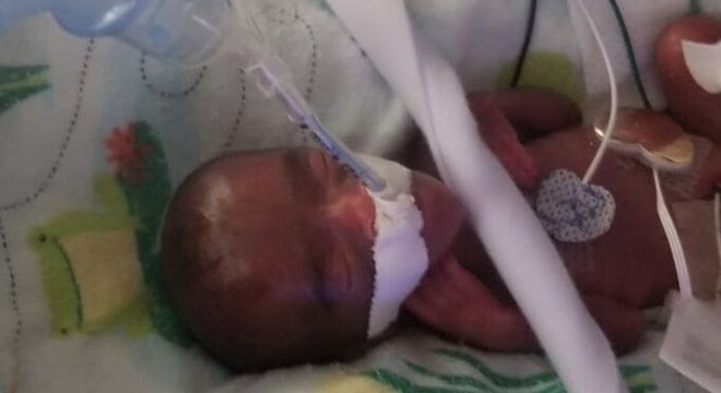Saybie nasceu de uma cesariana de emergência três meses antes do previsto 