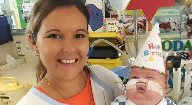 bebê prematuro extremo
