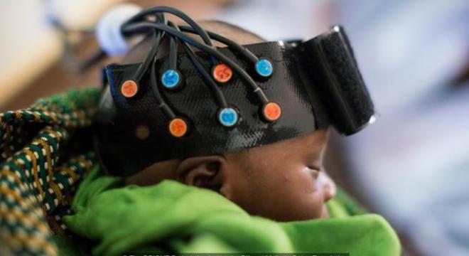  Pesquisadores do Babylab usam a espectroscopia em infravermelho para estudar os efeitos da desnutrição no cérebro dos bebês na Gâmbia