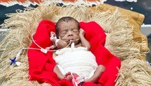 Bebês internados na UTI ganham ensaio fotográfico de Natal