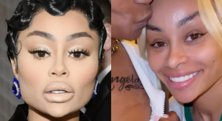 Blac Chyna compartilhou o antes e o depois nas redes sociais