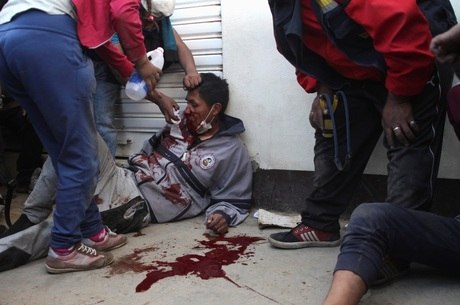 Homem ferido por policiais é atendido em El Alto, Bolívia