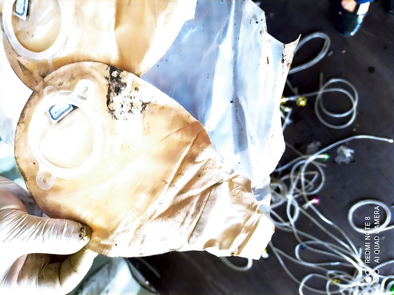 Bolsa de colostomia usada enviada de Portugal em 2021  (Reprodução/Ibama)