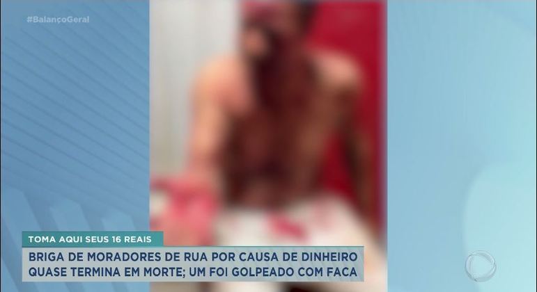 Esquisitões entram na faca e ficam com rostos assustadores - Fotos - R7  Hora 7