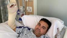 Buddy Valastro mostra estado da mão pela 1ª vez após acidente 