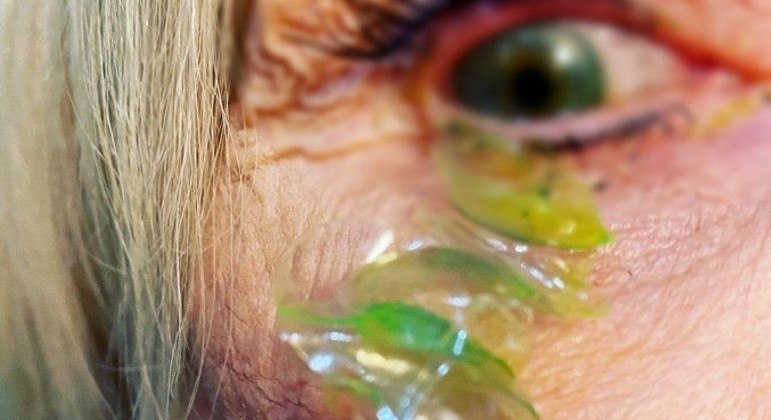 O atendimento, publicado no Instagram e TikTok, viralizou justamente pelas imagens muito fortes!CONFIRA AQUI A MATÉRIA NA ÍNTEGRA!
