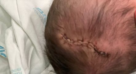 Polícia Civil já investiga o caso