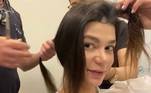 A atriz e professora de Yoga Pamela Otero também optou por fazer a cirurgia e corrigir uma falha que havia na frente do couro cabeludo