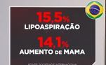 A cirurgia para aumentar as mamas é o segundo procedimento estético invasivo mais procurado no Brasil, atrás, apenas, da lipoaspiração. O levantamento mais recente mostra que são feitas quase 1,5 milhão de cirurgias plásticas por ano