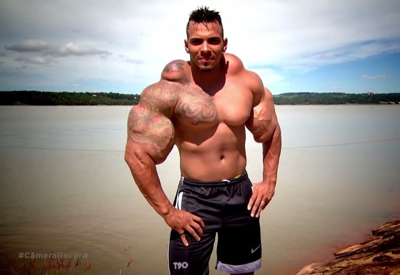 "Hulk Brasileiro" usou anabolizante perigoso para modificar o corpo