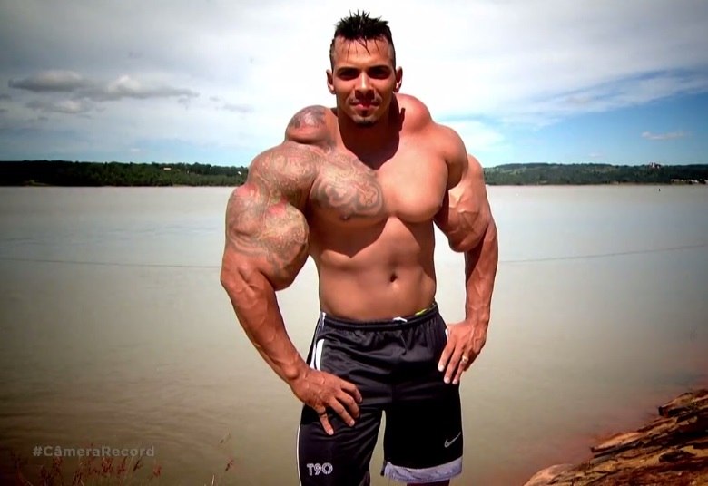 Hulk Brasileiro Usou Anabolizante Perigoso Para Modificar O Corpo Fotos R7 Câmera Record