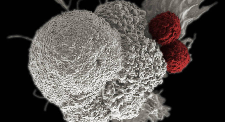 Análise genética de tumores pode predizer qual é o tratamento mais eficaz
