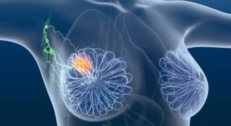 Tratamentos podem ser adaptados a partir de uma mutação genética dos tumores
