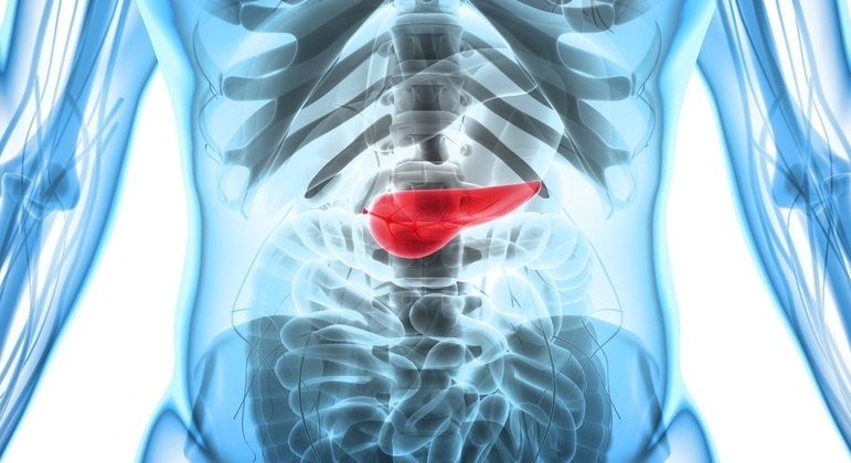 Câncer no pâncreas tem comportamento violento e é de difícil detecção 