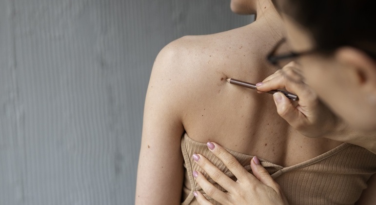 Câncer de pele é o tumor que mais acontece no Brasil, segundo o Inca