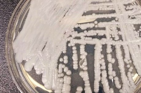 A infecção pelo Candida auris é resistente a medicamentos e pode ser fatal