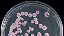 EUA: Fungos mortais são detectados em casas de repouso e hospitais
