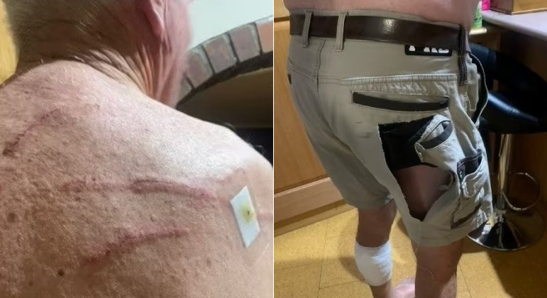 Fazendeiro sofreu ataque brutal de canguru, em propriedade na Austrália
