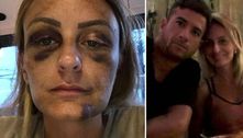 Ex-namorada de surfista que agrediu mulher em Bali conta violência que sofria de JP Azevedo