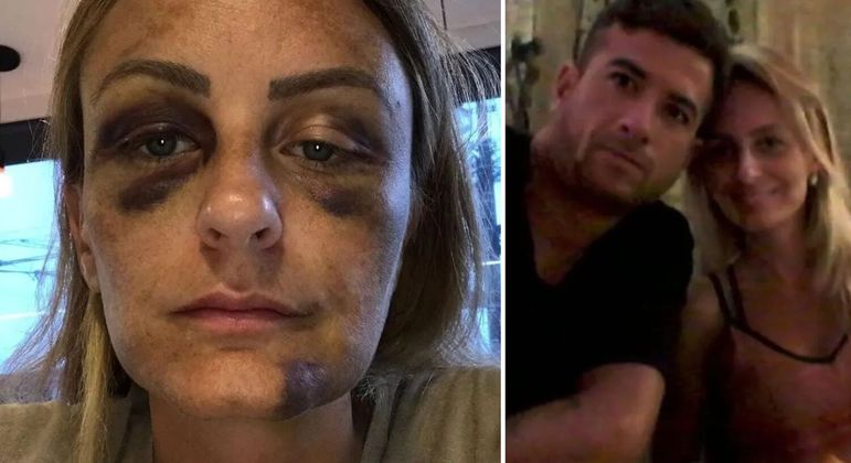 Ex-namorada de João Paulo Azevedo, Carolina Braga expôs a relação abusiva com o brasileiro