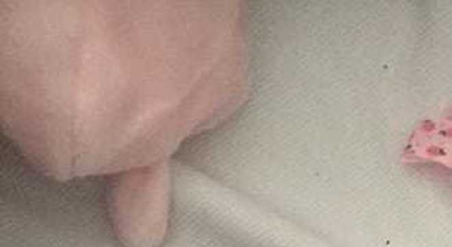 Carrinho da bebê queimada por cigarro