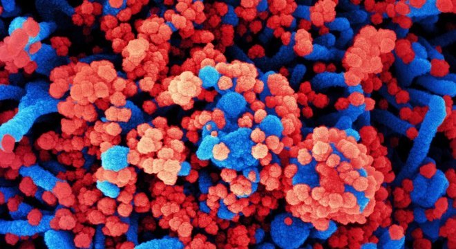 Células de paciente (em azul) infectadas com partículas do coronavírus (vermelho) em imagem do tipo micrografia eletrônica, divulgada pelo National Institutes of Health dos EUA