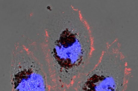Células humanas tratadas com nanopartículas de selenomelanina