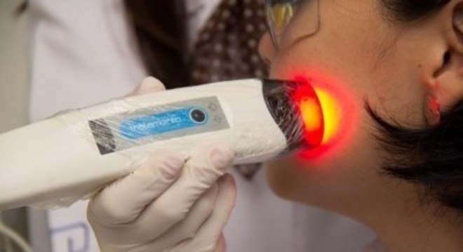 CEPID da FAPESP desenvolveu dispositivo para tratar câncer não melanoma
