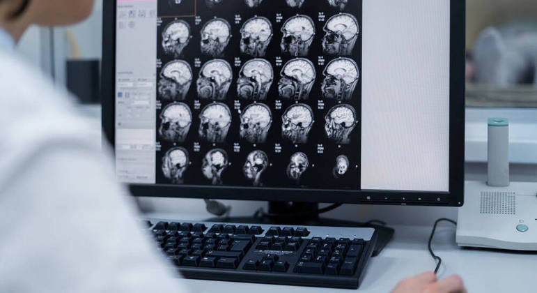 Cientistas sugerem alguns mecanismos cerebrais na entre TDAH e demência
