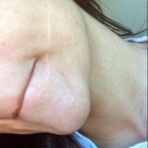 Jovem faz tratamento para a cicatriz no rosto até hoje